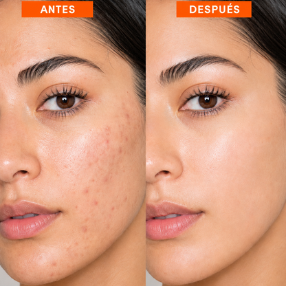 DragonLift™ | Crema Hidratante Antienvejecimiento